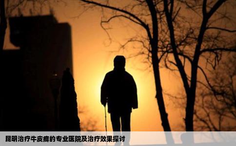 昆明治療牛皮癬的專業(yè)醫(yī)院及治療效果探討